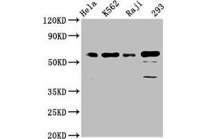 Western Blot Positive WB detected in: Hela whole cell lysate, K562 whole cell lysate, Raji whole cell lysate, 293 whole cell lysate All lanes: Cdc25C antibody at 1. (Recombinant CDC25C 抗体)
