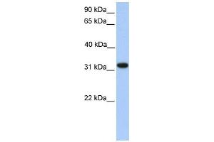 ETFA antibody used at 1 ug/ml to detect target protein. (ETFA 抗体)