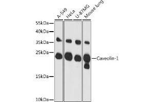 Western blot analysis of extracts of various cell lines, using Caveolin-1 antibody (ABIN6131271, ABIN6137992, ABIN6137993 and ABIN6218615) at 1:3000 dilution. (Caveolin-1 抗体  (AA 1-100))