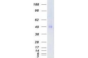 Western Blotting (WB) image for Transforming Growth Factor, beta Receptor 1 (TGFBR1) (Transcript Variant 1) protein (Myc-DYKDDDDK Tag) (ABIN2733515)