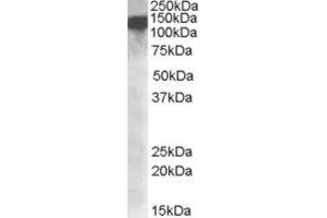 EB09297 (1µg/ml) staining of nuclear HeLa lysate (35µg protein in RIPA buffer). (DHX9 抗体  (Internal Region))