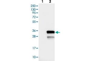 Western blot analysis of Lane 1: Negative control (vector only transfected HEK293T lysate), Lane 2: Over-expression Lysate (Co-expressed with a C-terminal myc-DDK tag (~3. (LYSMD1 抗体)