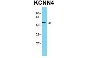 Western Blotting (WB) image for anti-Potassium Intermediate/small Conductance Calcium-Activated Channel, Subfamily N, Member 4 (KCNN4) (C-Term) antibody (ABIN2776147)