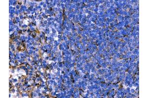 IHC analysis of Hsp47/SERPINH1 using anti-Hsp47/SERPINH1 antibody (ABIN3043331). (SERPINH1 抗体  (AA 247-418))
