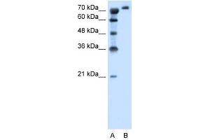 SLC6A18 antibody used at 1.
