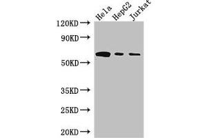 Western Blot Positive WB detected in: Hela whole cell lysate, HepG2 whole cell lysate, Jurkat whole cell lysate All lanes: HPSE antibody at 3 μg/mL Secondary Goat polyclonal to rabbit IgG at 1/50000 dilution Predicted band size: 62, 55, 54, 43 kDa Observed band size: 62 kDa (HPSE 抗体  (AA 263-523))