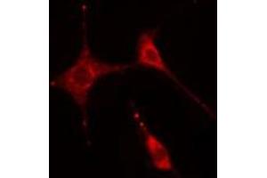 ABIN6269331 staining  HeLa cells by IF/ICC. (Caldesmon 抗体  (C-Term))