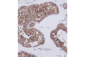Immunohistochemistry (Paraffin-embedded Sections) (IHC (p)) image for anti-Voltage-Dependent Anion Channel 3 (VDAC3) (AA 156-183) antibody (ABIN1537893)