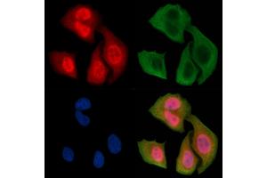ABIN6256440 and ABIN6267350 staining Hela cells(30 min of UV treatment) by IF/ICC. (Bcl-2 抗体  (pSer87))