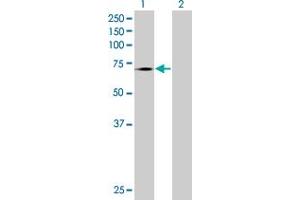 Western Blotting (WB) image for TLR4 293T Cell Transient Overexpression Lysate(Denatured) (ABIN1333743)