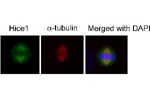 Immunofluorescence analysis of human osteosarcoma cell line U2OS, using HICE1 antibody at 1:50-1:200 dilution. (NYS48/HAUS8 抗体)