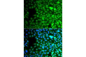 Immunofluorescence analysis of A549 cell using ZNF195 antibody. (ZNF195 抗体)