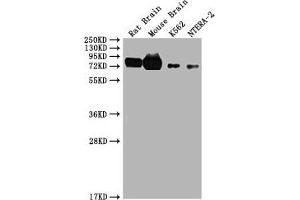 Western Blot Positive WB detected in: Rat brain tissue, Mouse brain tissue, K562, NTERA-2 All lanes: WASF1 antibody at 1. (WASF1 抗体  (AA 381-553))