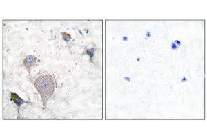 Immunohistochemistry (IHC) image for anti-Peripherin (PRPH) (C-Term) antibody (ABIN1848740) (Peripherin 抗体  (C-Term))