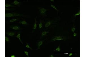Immunofluorescence of monoclonal antibody to BCL9 on HeLa cell. (BCL9 抗体  (AA 1036-1135))