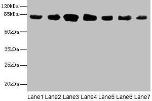 Western blot All lanes: CLGN antibody at 7 μg/mL Lane 1: Mouse brain tissue Lane 2: Mouse lung tissue Lane 3: Jurkat whole cell lysate Lane 4: HepG2 whole cell lysate Lane 5: PC-3 whole cell lysate Lane 6: Hela whole cell lysate Lane 7: HL60 whole cell lysate Secondary Goat polyclonal to rabbit IgG at 1/10000 dilution Predicted band size: 71, 47 kDa Observed band size: 80 kDa (Calmegin 抗体  (AA 200-400))