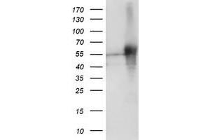 Western Blotting (WB) image for anti-SH2 Domain Protein 2A (SH2D2A) antibody (ABIN1500914) (SH2D2A 抗体)