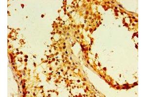 Immunohistochemistry of paraffin-embedded human testis tissue using ABIN7173881 at dilution of 1:100 (Ectodysplasin A2 Receptor 抗体  (AA 1-138))