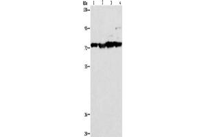 Western Blotting (WB) image for anti-Matrix Metallopeptidase 15 (Membrane-inserted) (MMP15) antibody (ABIN2421859) (MMP15 抗体)