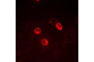 Immunofluorescent analysis of CG alpha staining in MCF7 cells. (CGA 抗体)