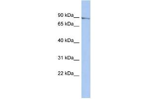 WB Suggested Anti-MLH1 Antibody Titration: 0. (MLH1 抗体  (N-Term))