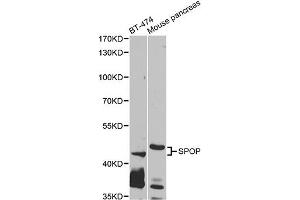 Western blot analysis of extracts of various cell lines, using SPOP antibody. (SPOP-B 抗体)