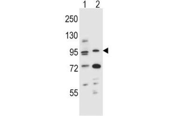 Aryl Hydrocarbon Receptor anticorps  (AA 555-582)