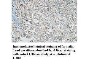Image no. 1 for anti-alpha-1-B Glycoprotein (A1BG) antibody (ABIN791226) (A1BG 抗体)