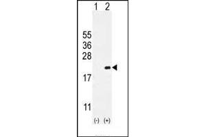 Western blot analysis of CDKN2C (arrow) using rabbit polyclonal CDKN2C Antibody (C-term) (ABIN654908 and ABIN2844555). (CDKN2C 抗体  (C-Term))