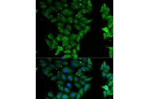 Immunofluorescence (IF) image for anti-E74-Like Factor 3 (Ets Domain Transcription Factor, Epithelial-Specific) (ELF3) antibody (ABIN7008292)