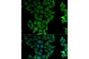 Immunofluorescence analysis of MCF7 cells using ELF3 Polyclonal Antibody (ELF3 抗体)
