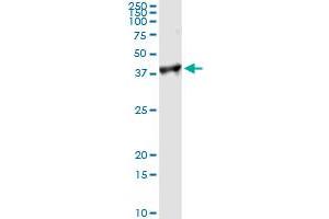 Immunoprecipitation (IP) image for anti-Proliferating Cell Nuclear Antigen (PCNA) (AA 1-261) antibody (ABIN562135)