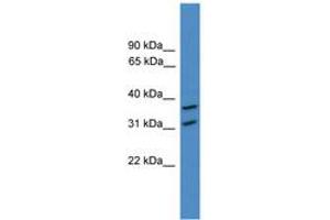 Image no. 1 for anti-OTU Domain Containing 6A (OTUD6A) (AA 51-100) antibody (ABIN6745381) (OTUD6A 抗体  (AA 51-100))