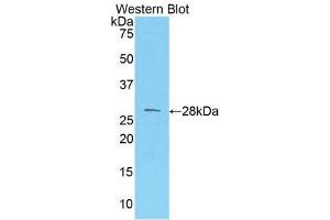 Western Blotting (WB) image for anti-Melanoma Cell Adhesion Molecule (MCAM) (AA 324-565) antibody (ABIN1859776) (MCAM 抗体  (AA 324-565))