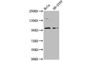 Western Blot Positive WB detected in: Hela whole cell lysate, SH-SY5Y whole cell lysate All lanes: PDE6C antibody at 3. (PDE6C 抗体  (AA 285-451))