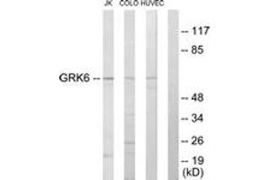 Western blot analysis of extracts from Jurkat/COLO205/HuvEc cells, using GRK6 Antibody.
