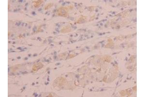 Immunohistochemistry (IHC) image for anti-Tumor Necrosis Factor (Ligand) Superfamily, Member 14 (TNFSF14) (AA 62-240) antibody (ABIN7436990)