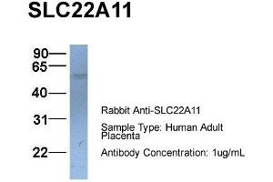 Host:  Rabbit  Target Name:  SLC22A11  Sample Type:  Human Adult Placenta  Antibody Dilution:  1. (SLC22A11 抗体  (C-Term))