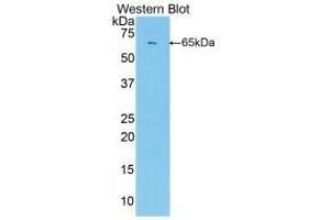 Detection of recombinant PBRM1 using Polyclonal Antibody to Polybromo 1 (PBRM1) (Polybromo 1 抗体  (AA 1-306))