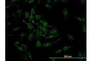 Image no. 3 for anti-Cofilin 2 (CFL2) (AA 57-167) antibody (ABIN598607) (Cofilin 2 抗体  (AA 57-167))