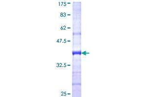 DCAF10 Protein (AA 1-110) (GST tag)
