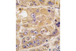 Immunohistochemistry (Paraffin-embedded Sections) (IHC (p)) image for anti-Low Density Lipoprotein Receptor Adaptor Protein 1 (LDLRAP1) (AA 277-306), (C-Term) antibody (ABIN392554)