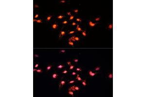 Immunofluorescence analysis of C6 cells using GTF3C4 Polyclonal Antibody  at dilution of 1:100 (40x lens). (GTF3C4 抗体  (AA 583-822))