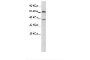Image no. 2 for anti-PR Domain Containing 14 (PRDM14) (AA 208-257) antibody (ABIN202775) (PRDM14 抗体  (AA 208-257))