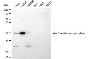Western blotting analysis using thymidine phosphorylase antibody (ABIN7800552).