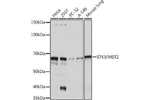 Western blot analysis of extracts of various cell lines, using STK3/MST2 Rabbit mAb (ABIN7270223) at 1:1000 dilution. (STK3 抗体)