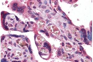 Human Placenta: Formalin-Fixed, Paraffin-Embedded (FFPE) (Transferrin Receptor 抗体  (AA 169-377))