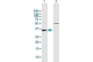 Western Blot analysis of SLC14A1 expression in transfected 293T cell line by SLC14A1 MaxPab polyclonal antibody. (SLC14A1 抗体  (AA 1-389))