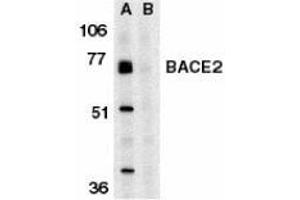Western blot analysis of BACE2 in human heart tissue lysate in the absence (A) or presence (B) of blocking peptide with AP30113PU-N BACE2 antibody at 1 μg/ml. (BACE2 抗体  (C-Term))