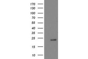 Western Blotting (WB) image for anti-NADH Dehydrogenase (Ubiquinone) 1 beta Subcomplex, 9, 22kDa (NDUFB9) (AA 3-179) antibody (ABIN1491362) (NDUFB9 抗体  (AA 3-179))